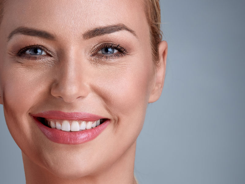 schematics of botox and fillers treated areas by dentist in Waterlooville